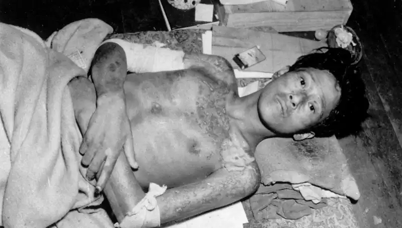 80 Yıl Sonra Nagasaki’den Gelen Acil Uyarı: Nükleer Felaket Riski Artıyor!