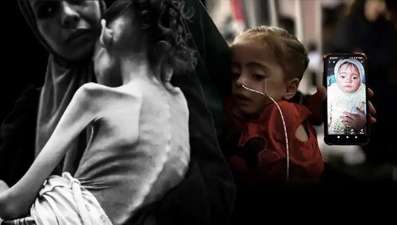 Küçük Meryem’in Zorlu Mücadelesi: 25 Kilodan 10 Kiloya Düşen Çocuk